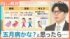 TBS NEWS DIG