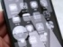 iOS 26のベータ版