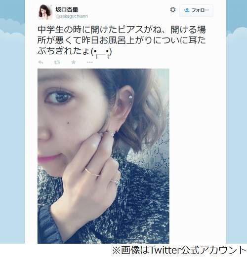 つぶやき一覧 坂口杏里の耳たぶがちぎれる Mixiニュース